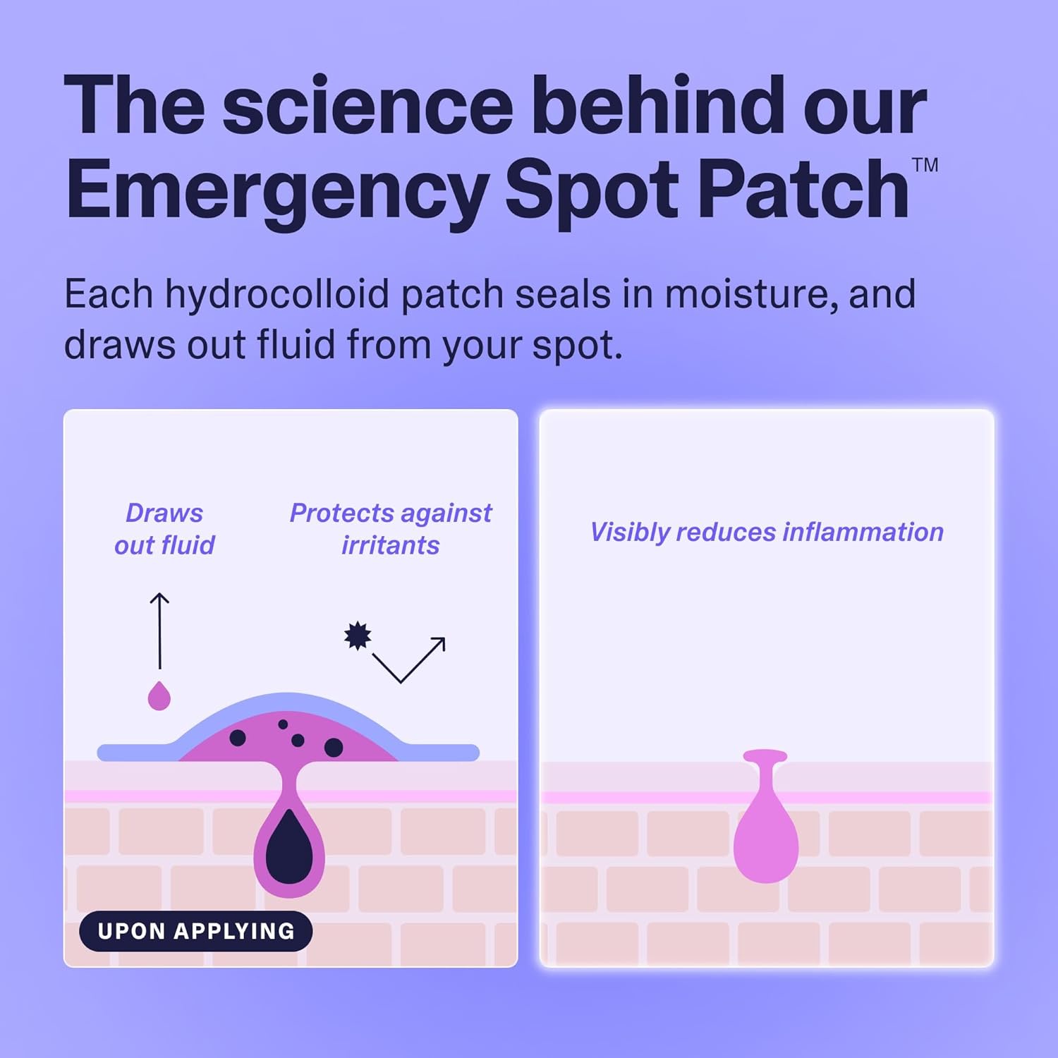 Curology Emergency Spot Pimple Patches For Face, Hydrocolloid Pimple Patches Fast-Acting, 80 Count : Beauty & Personal Care