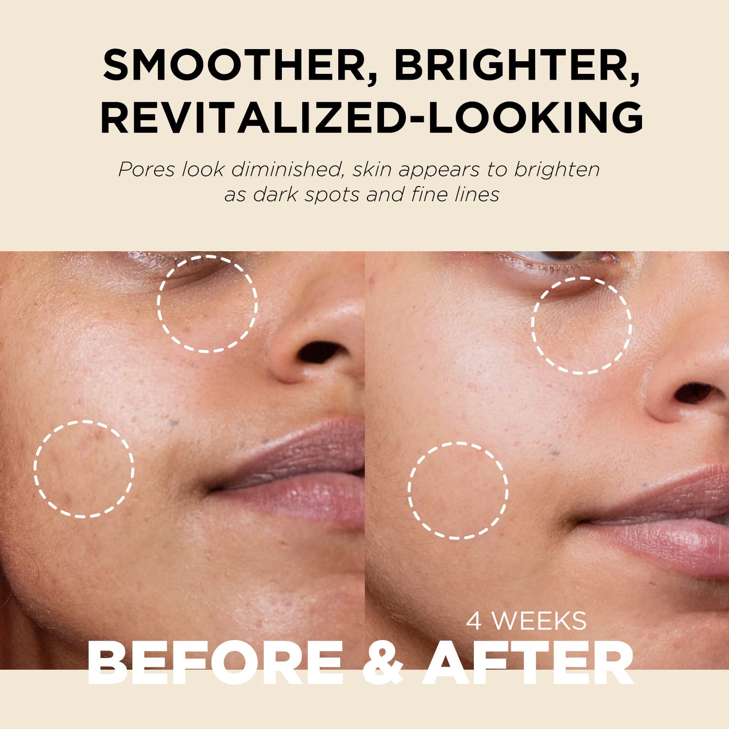 It'S Skin Retinoidin Cream - Retinol Anti Aging Face Moisturizer - Smooth Wrinkles & Fine Lines - Firming & Moisturizing With Adenosine, Hyluronic Acid, Peptides, Niacinamide And Ceramide, 3.38 Oz. : Video Games