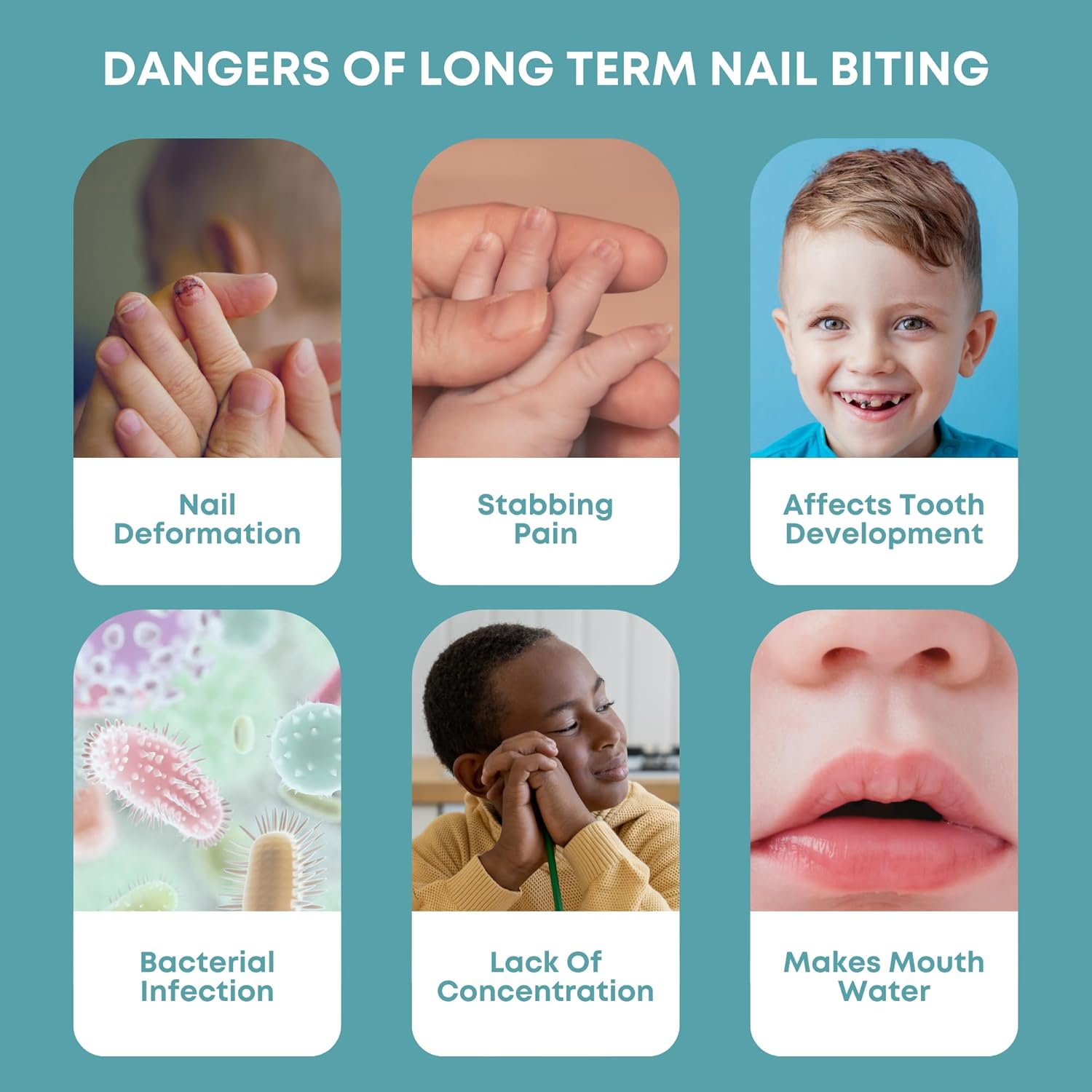 Natural Nail Biting & Thumb Sucking Solution | 100% Natural Kid Safe Bitter Taste Deterrent | Gentle On Skin, Teeth, Nails | Kids, Adults & Teens | 21 Consecutive Days To See Results