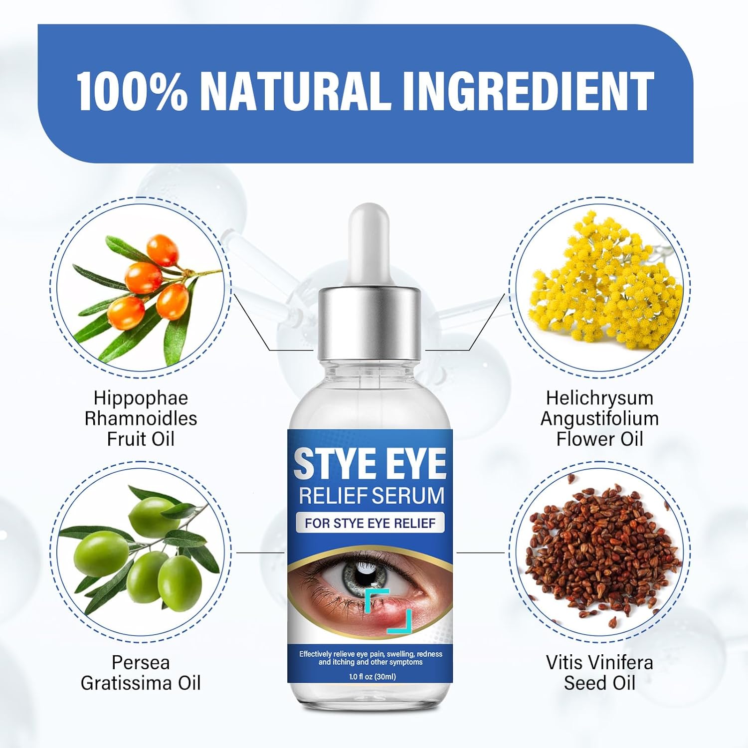 Stye Eye Treatment, Natural Stye Eye Relief Drops Serum For Styes Chalazion And Blepharitis, Fast Chalazion Remover For Restore Healthier Skin-1 Fl Oz : Everything Else