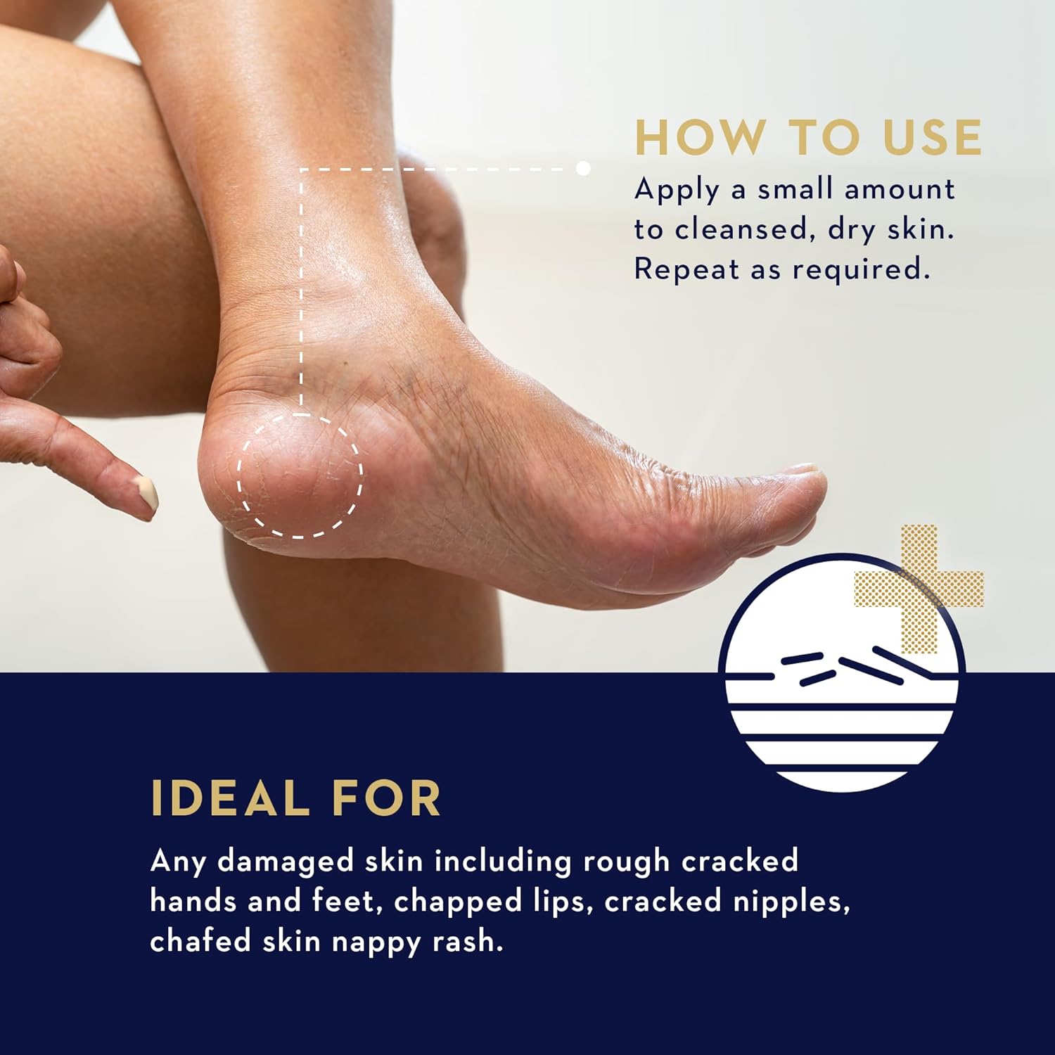 Manuka Health Manuka Rescue Balm - Medical Grade Manuka Honey Wound Care With Aloe, Beeswax & Calendula – Fast Acting, Long Lasting Care For Stressed & Rough Skin, 1.69Oz? : Beauty & Personal Care