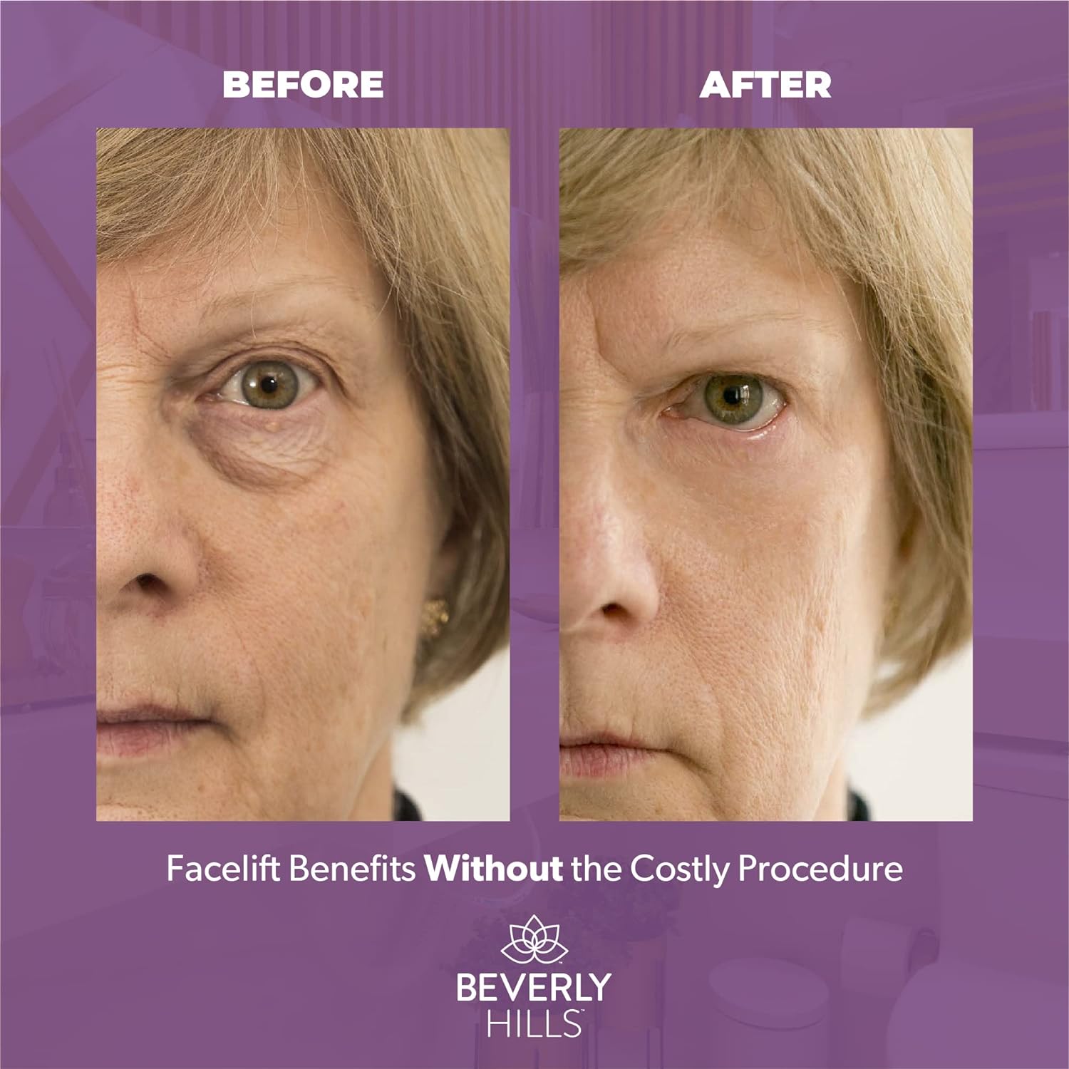 Beverly Hills Instant Facelift Anti Aging Eye Serum Treatment for Dark Circles, Puffy Eyes, Wrinkles, Under Eye Bags, Fine Lines, and Crows Feet | 30mL (120 Days Supply) : Beauty & Personal Care