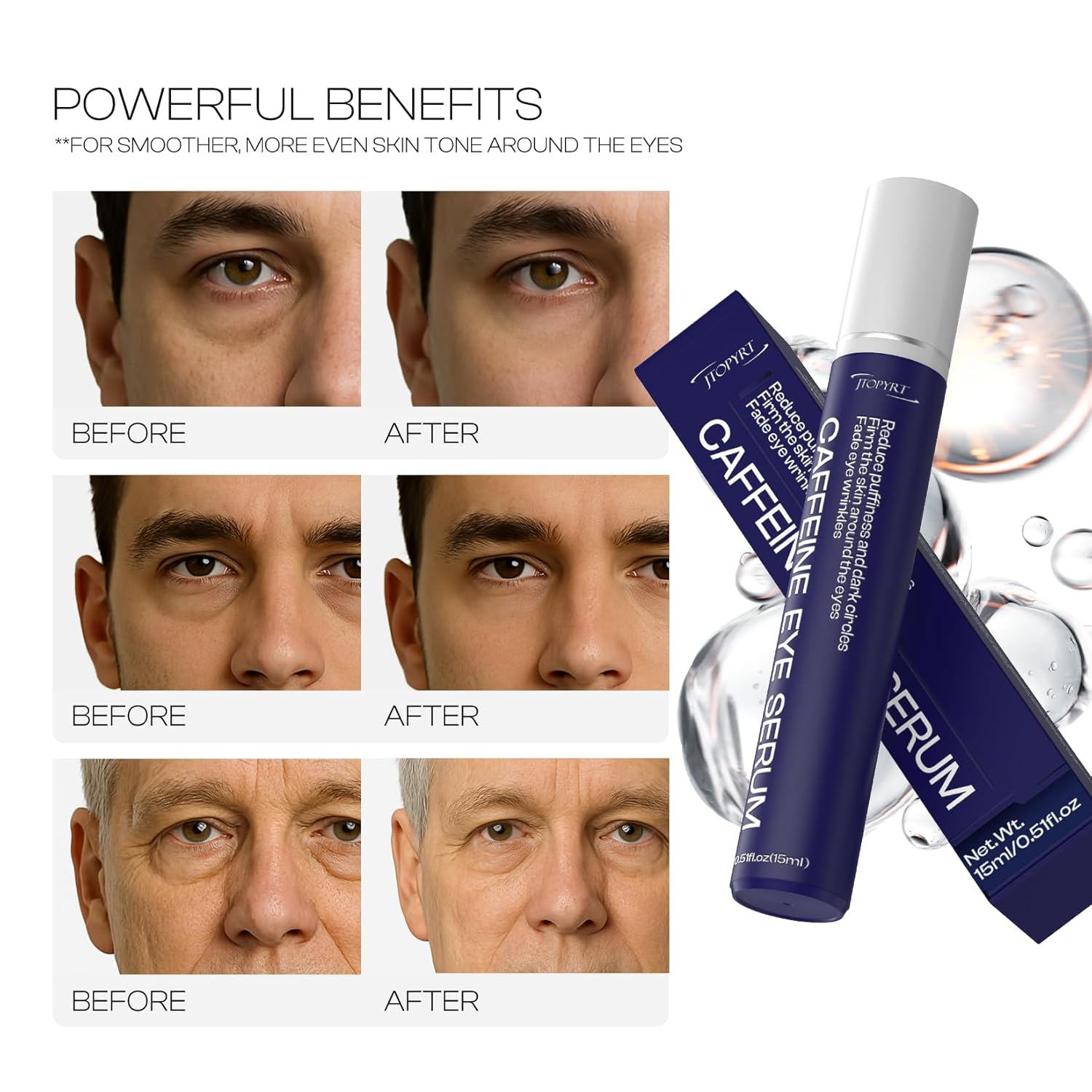 Jtopyrt Eye Bags Treatment For Men: Depuffing And Firming - Hydrates And Nourishes The Delicate Eye Area For Daily Use By Men 15Ml : Beauty & Personal Care