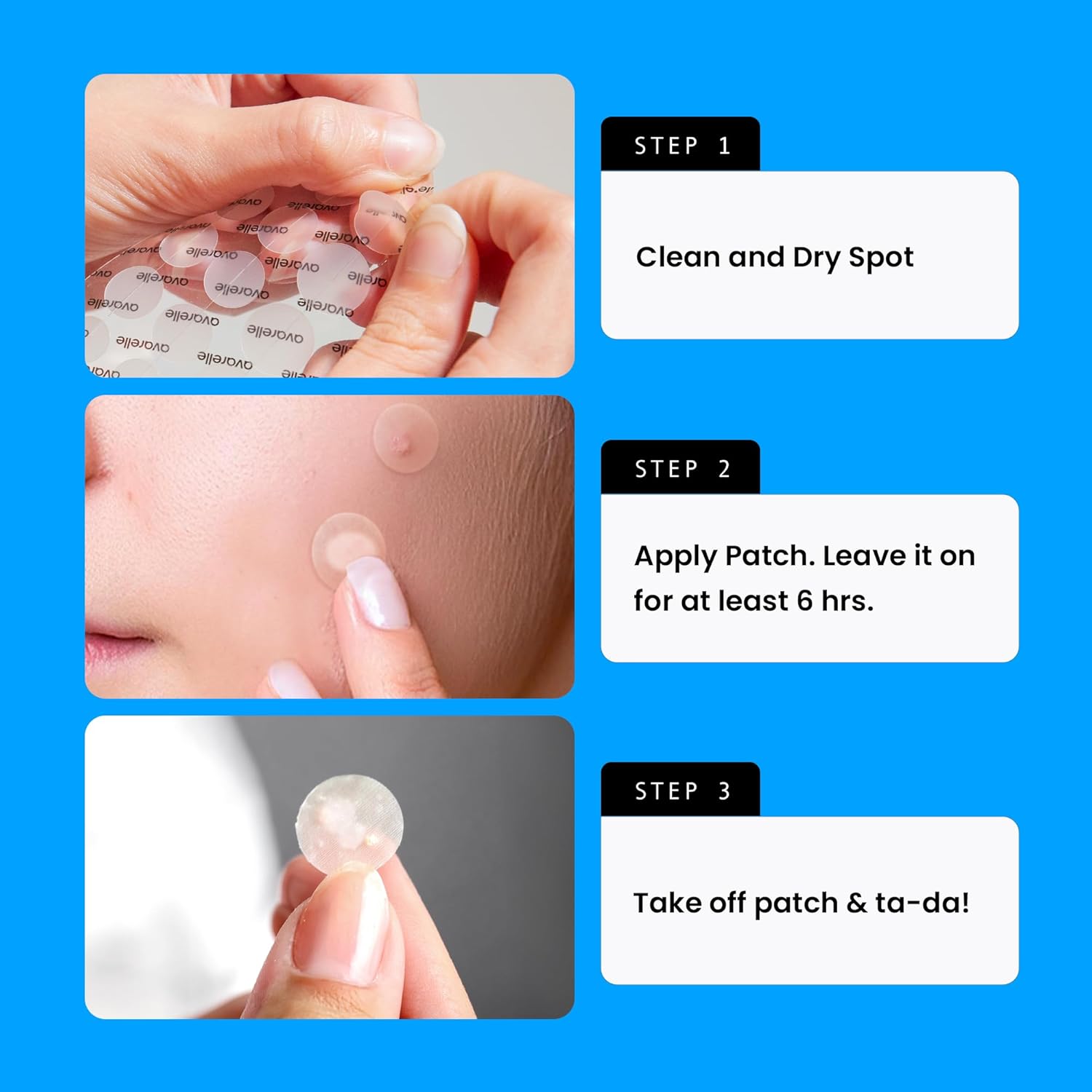 Avarelle Pimple Patches Double Variety Duo Hydrocolloid Acne Patches, For Blemishes And Zit With Tea Tree Oil, Calendula Oil And Cica Oil For Face, Vegan, Cruelty Free (80 Count + Variety) : Beauty & Personal Care