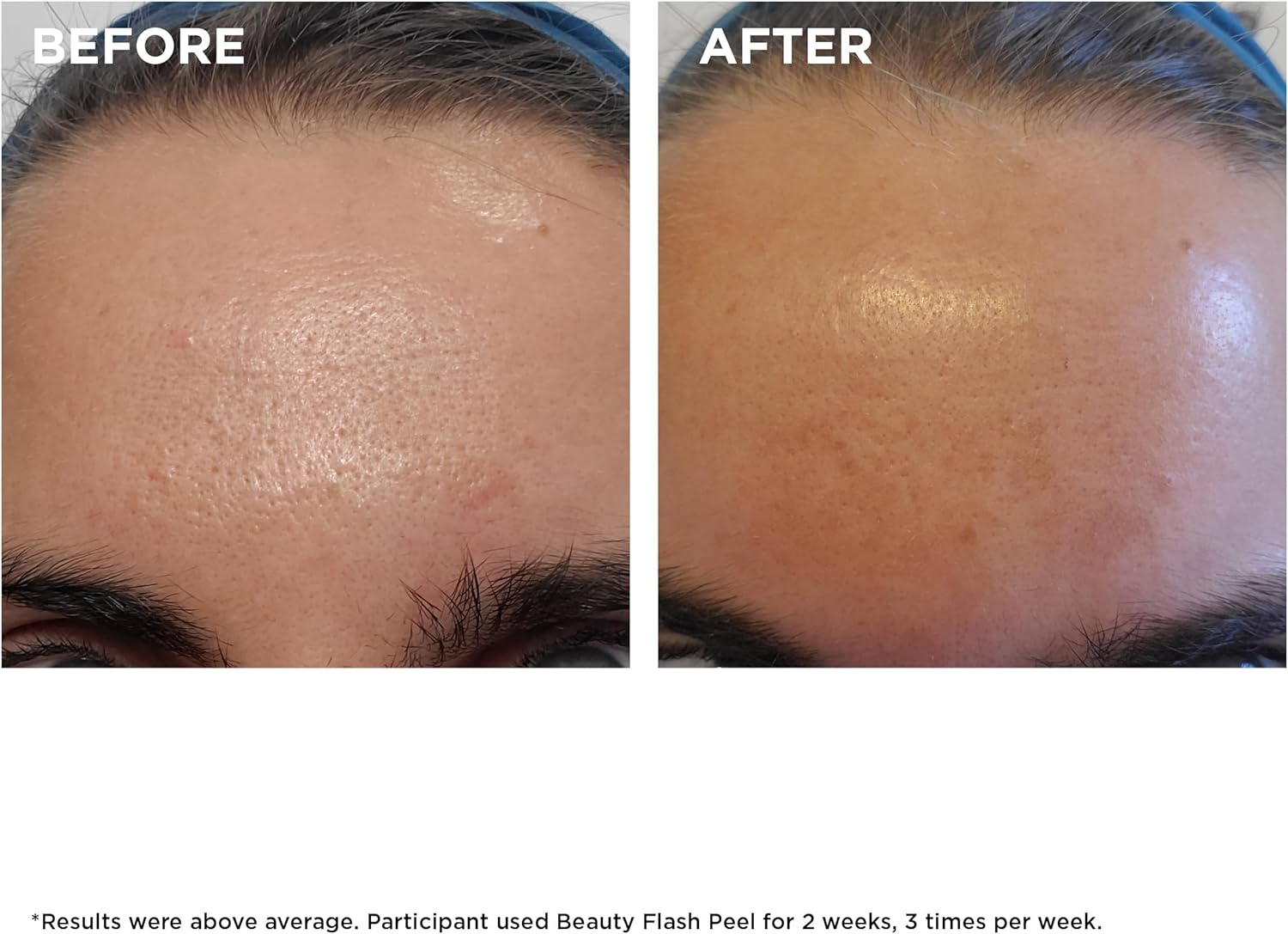 Clarins Beauty Flash Peel 50ml : Amazon.co.uk: Beauty