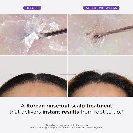 Dr. Groot Miracle In Shower Treatment For Hair Loss, Korean Hair Care, 5 Seconds To Smooth Hair, Rosemary Oil For Healthier-Looking Hair, Hair Rinse, Moisturizing Treatment,Scalp Revitalizing Solution