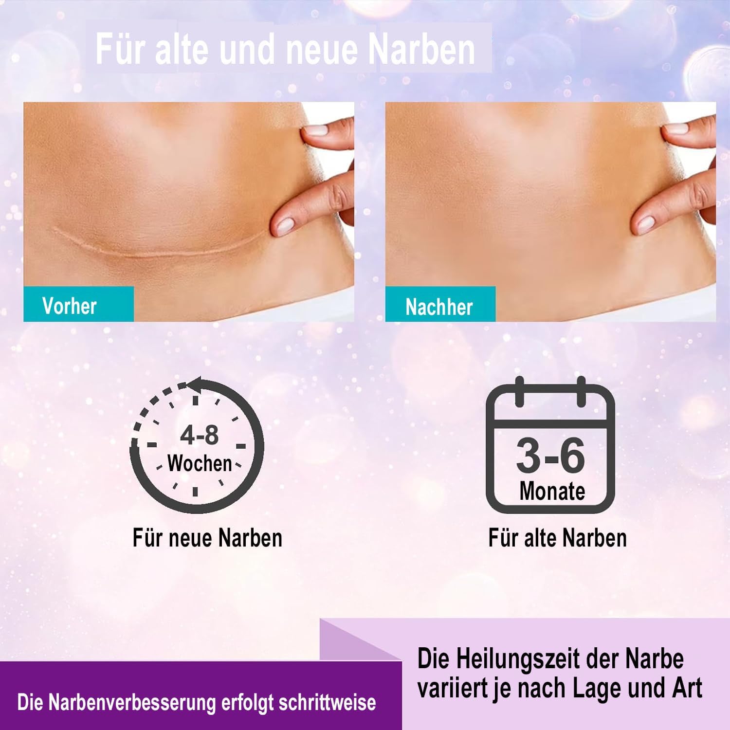 Silicone Gel Scar Sheets For Surgical Scars: Reusable Scar Tape For C-Section, Tummy Tuck, Keloid - Soft Medical Grade Silicone Scar Removal Strips(1.6'' X 120''Roll)