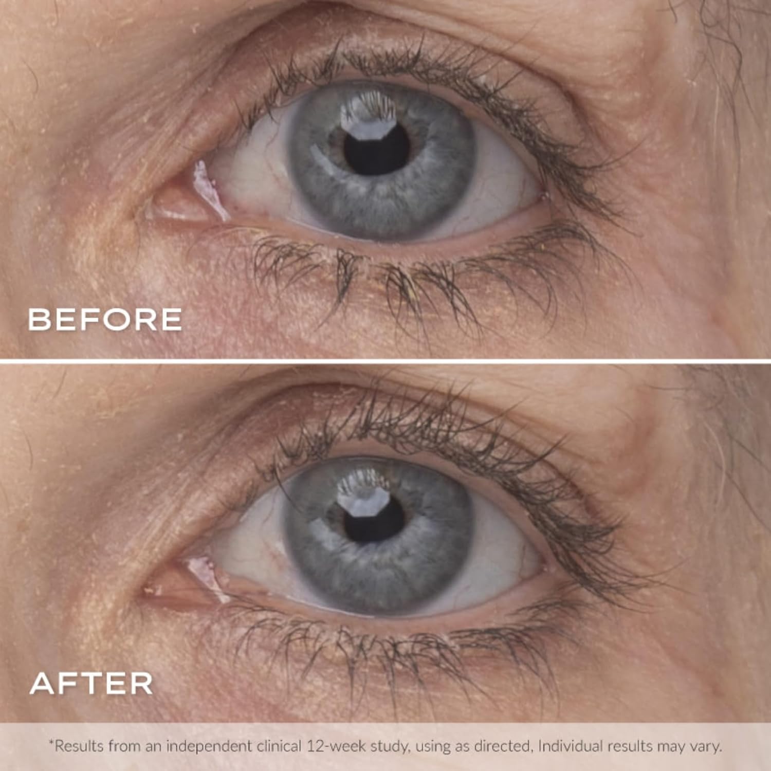 Younique'S Moodstruck Esteem Lash Serum | Eyelash Serum For Longer, Thicker And Stronger Lashes : Beauty & Personal Care