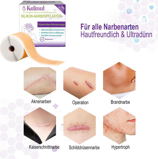 Silicone Gel Scar Sheets For Surgical Scars: Reusable Scar Tape For C-Section, Tummy Tuck, Keloid - Soft Medical Grade Silicone Scar Removal Strips(1.6'' X 120''Roll)
