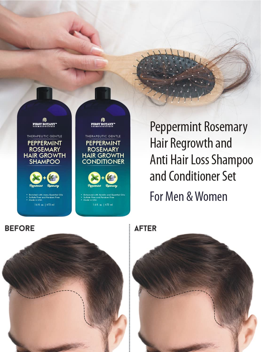 First Botany, Peppermint Rosemary Hair Regrowth and Anti Hair Loss Shampoo and Conditioner Set - Daily Hydrating, Detoxifying, Volumizing Shampoo and Fights Dandruff For Men and Women 16 fl oz x 2 : Beauty & Personal Care