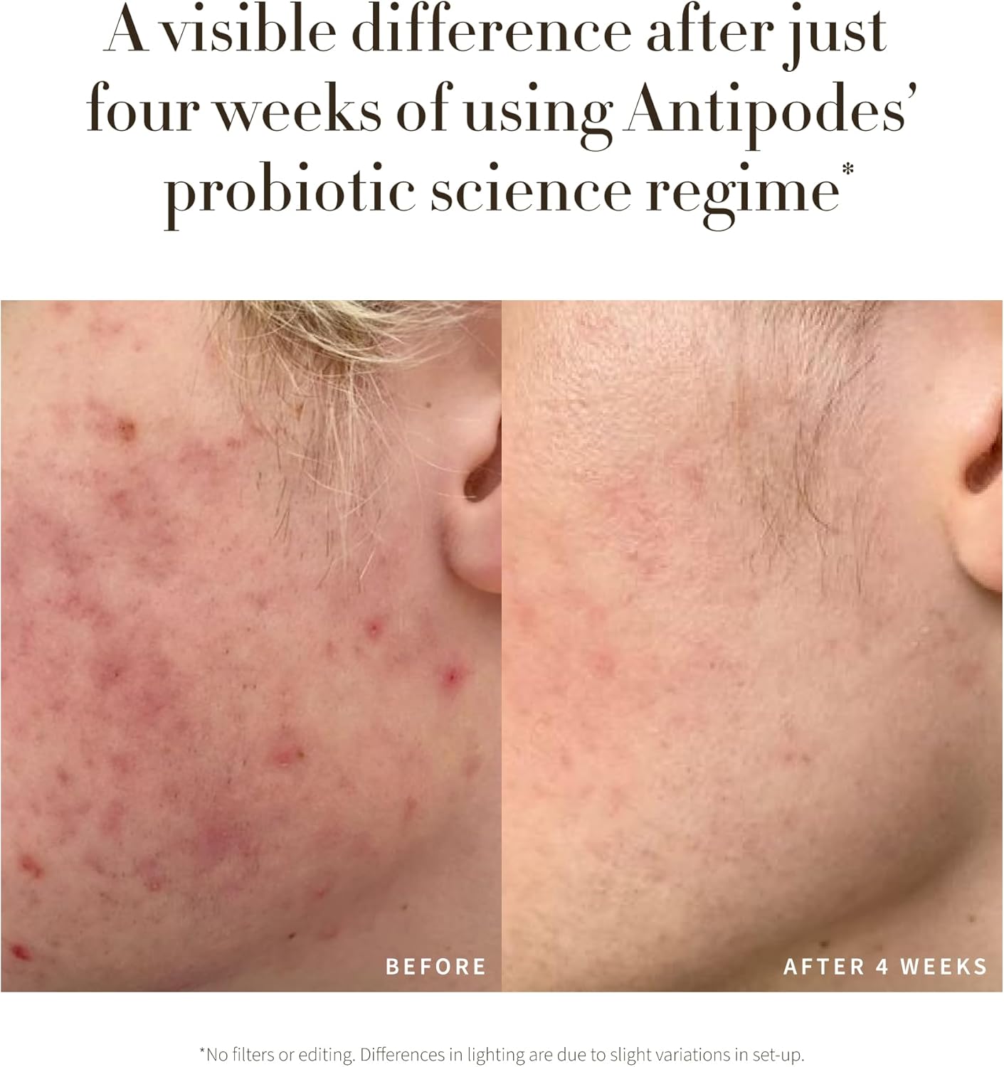 Antipodes Credo Probiotic Anti-Blemish Serum – Anti Blemish Serum with Probiotics for Healthy Skin – Hyaluronic Acid – 30ml : Amazon.co.uk: Beauty