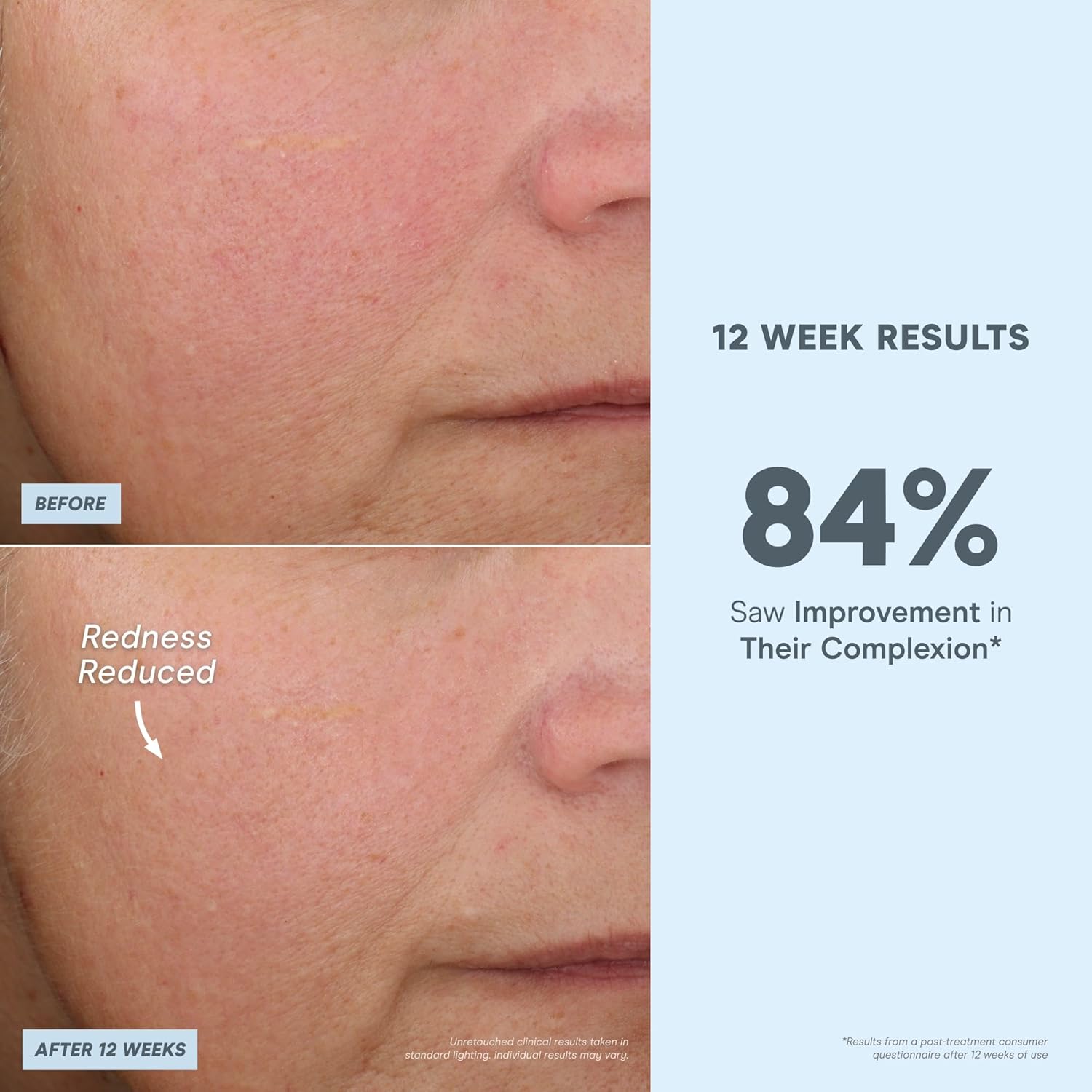 Nuface Antioxidant Serum - Facial Firming, Smoothing & Tightening Serum To Shield And Protect Against Blue Light - Multi-Use Skincare & Super Booster For Nuface Microcurrent Device Results (1 Oz) : Beauty & Personal Care