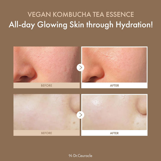 Dr.Ceuracle Vegan Kombucha Tea Essence - Hydrating Milky Toner With Kombucha Tea Extract, Centella Asiatica, Ceramide, Korean Skincare (150 Ml / 5.07 Fl. Oz.)
