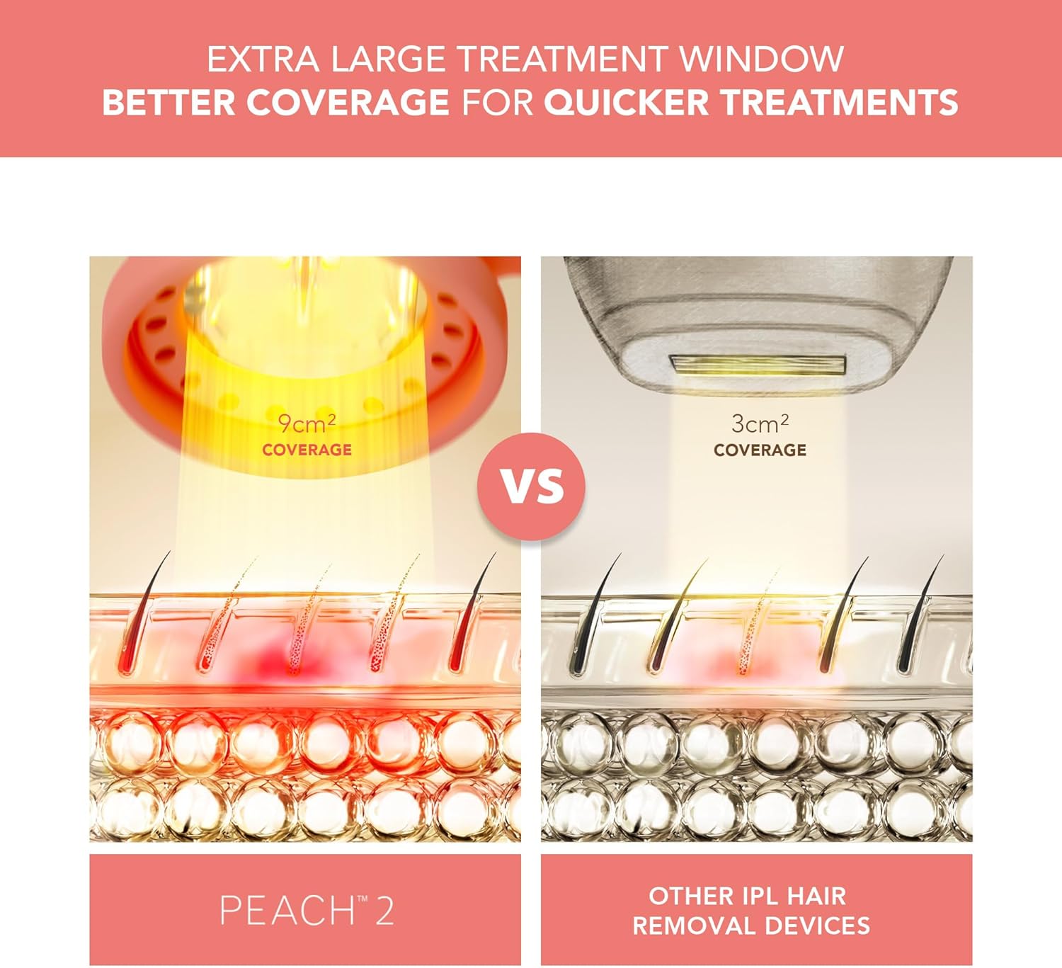 FOREO Peach 2 IPL Hair Removal Device + Calming & Hydrating IPL Peach Cooling Prep Gel - Permanent Removal - Laser Removal for Body & Face - Skin Cooling Technology & Silicone Shield : Amazon.co.uk: Health & Personal Care