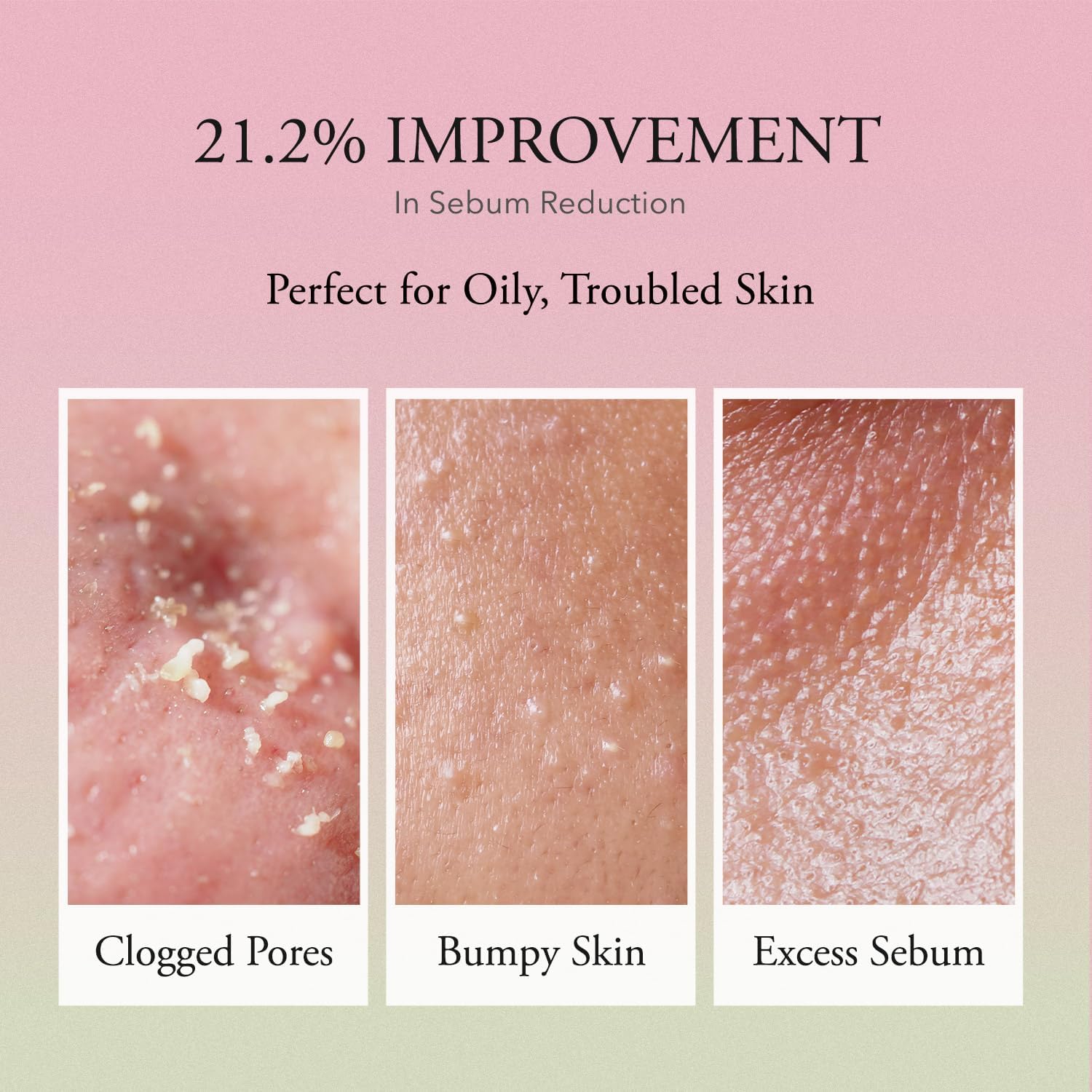 Aprilskin Pink Aloe Vita Toner | Calms And Soothes Redness, Smoothens, And Controls Excess Sebum | 80% Pink Aloe Vera Water | Hydrating, Non-Sticky | Clean & Vegan Korean Skin Care (8.45 Fl.Oz) : Beauty & Personal Care