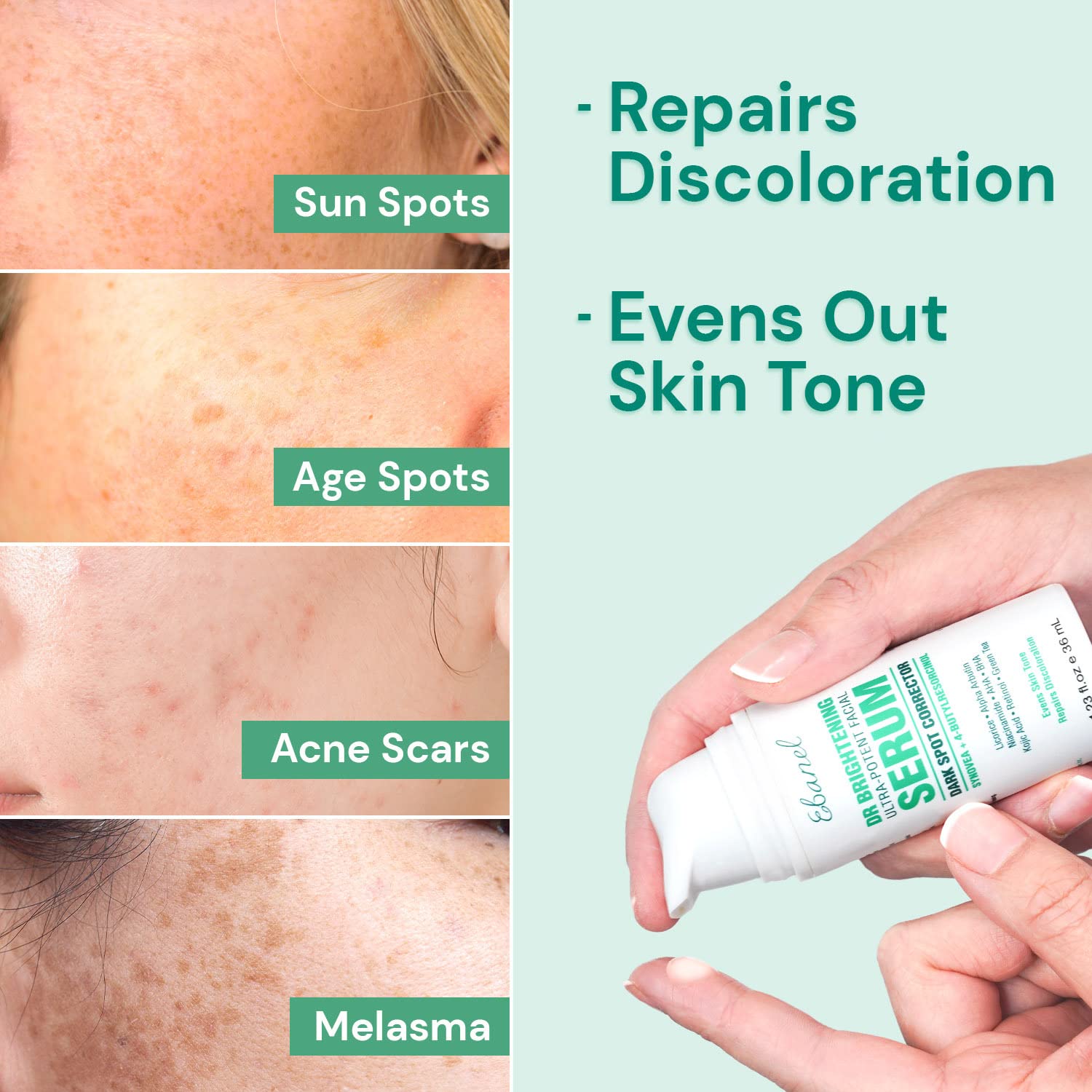 Ebanel Dark Spot Remover for Face Peel Skin Brightening Serum Melasma Hyperpigmentation Treatment, Sun Spot Age Spot Remover, with Synovea HR, 4-Butylresorcinol, Niacinamide, Kojic Acid : Beauty & Personal Care