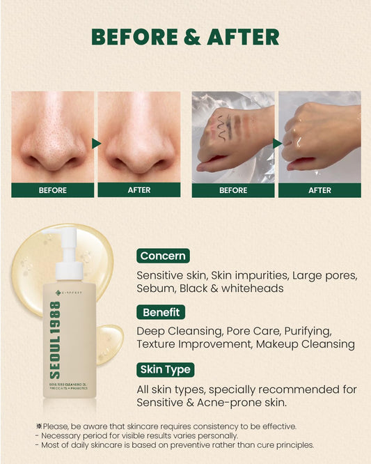 Ksecret Seoul 1988 Cleansing Oil : Pine Cica 1% + Probiotics, 200Ml/6.76Fl.Oz