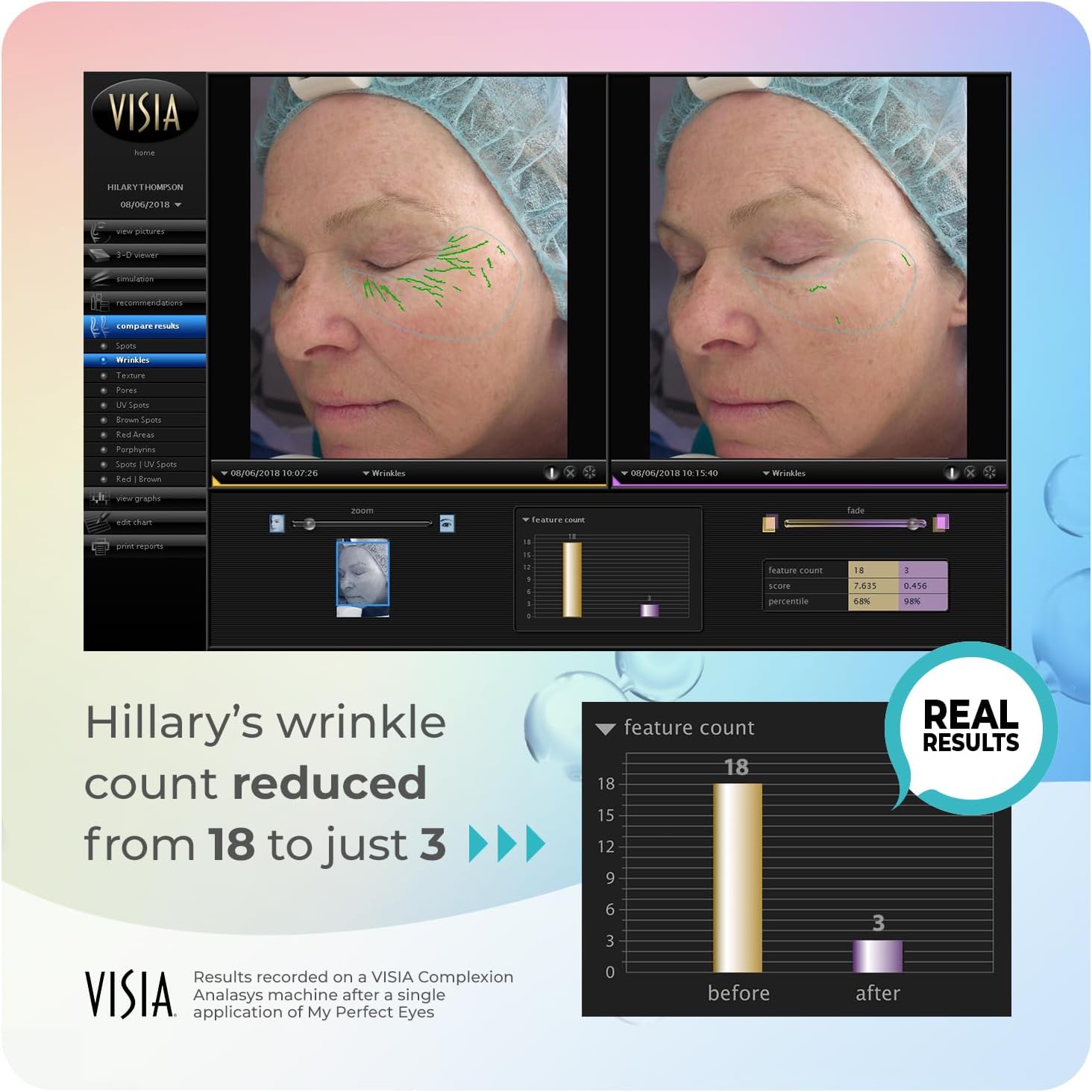 My Perfect Eyes 20ml, 200 Applications, Penny Lane, Instant Results, Clinically Proven, Anti-Ageing Serum UK Original Formula, Science-Backed Anti-Wrinkle Serum. As Seen on TV. : Amazon.co.uk: Beauty