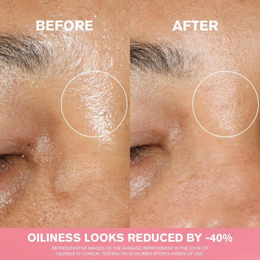 Estée Lauder Nutritious Radiant Essence Treatment Lotion Toner With Niacinamide | Pore Minimizing Skin Essence, 6.7 Fl Oz