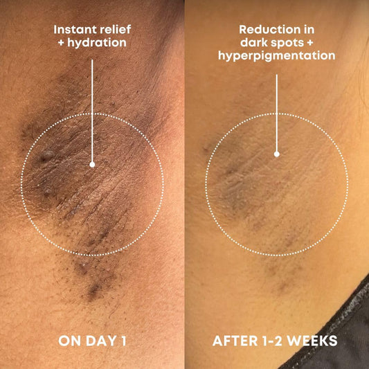 Bushbalm Dark Spot Exfoliating Scrub – Pre-Shave Sugar Scrub For Dark Spots, Hyperpigmentation, Razor Bumps & Dry Skin – Gently Buffs & Soothes Sensitive Skin - Bermuda 236 Ml