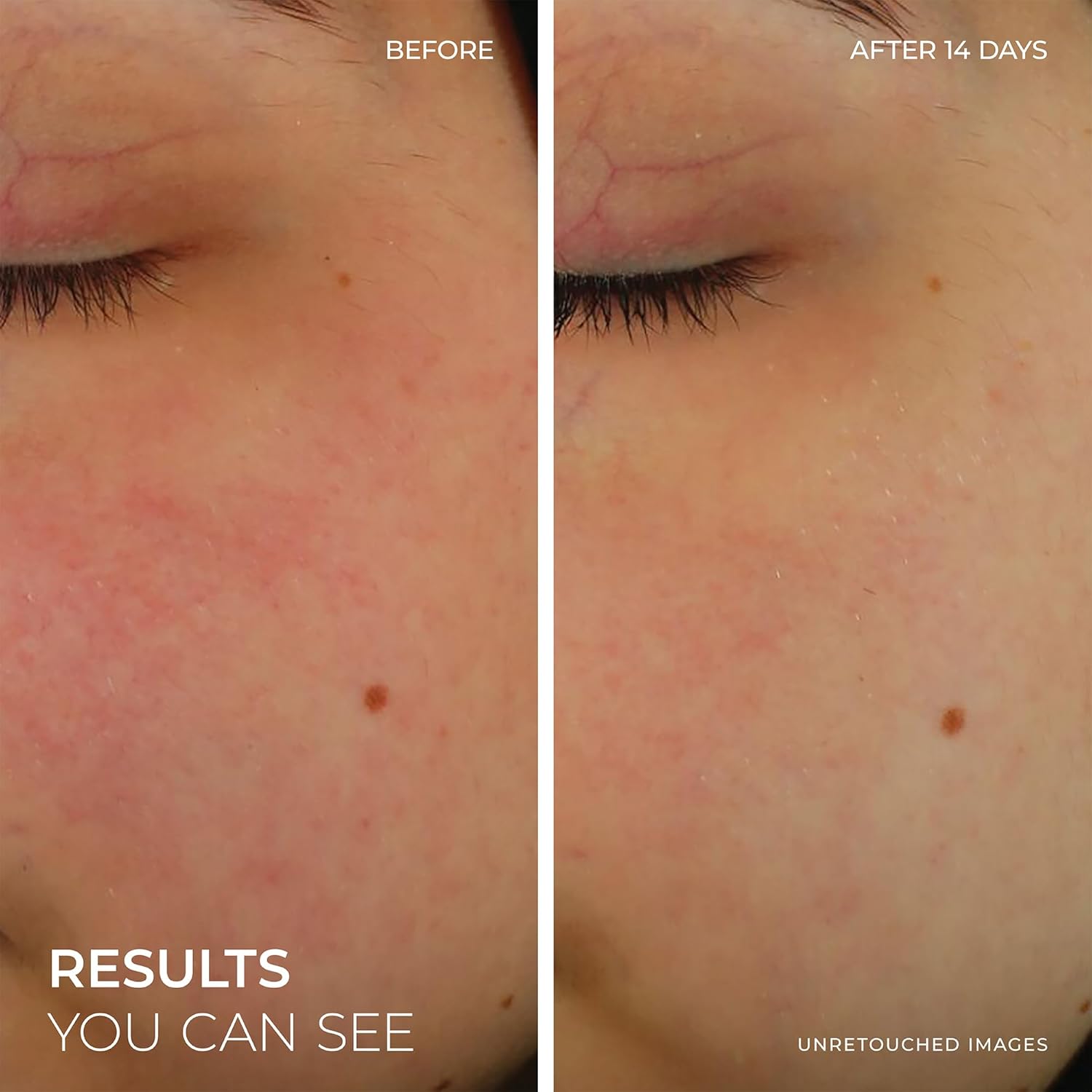 Roc Barrier Renew Bundle: Night Moisturizer, 2.5Oz + Day Cream With Spf 30, 2.5Oz + Barrier Renew Gel To Foam Non Drying Cleanser, 12Oz : Beauty & Personal Care