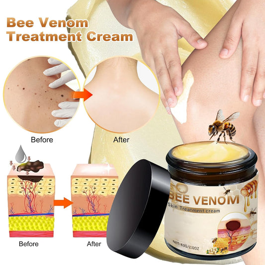 Bee Venom Skin Treatment Cream, Bee Venom Comprehensive Skincare Cream, 2025 New Professional Bee Venom Gel, Bee Venom Moisturizing Gel For All Skin Types (2Pcs)