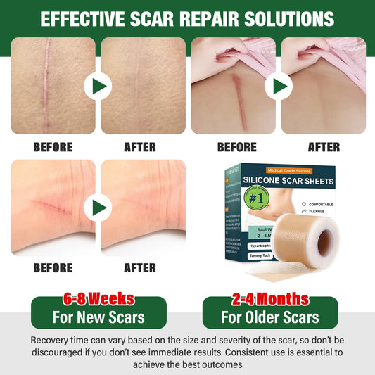 Silicone Scar Sheets,Silicone Scar Tape,Silicone Sheets For Scars,Scar Tape For Surgical Scars,Keloid Bump Removal,Scar Removal For Surgical(1.6"X 60" Roll-1.5M)