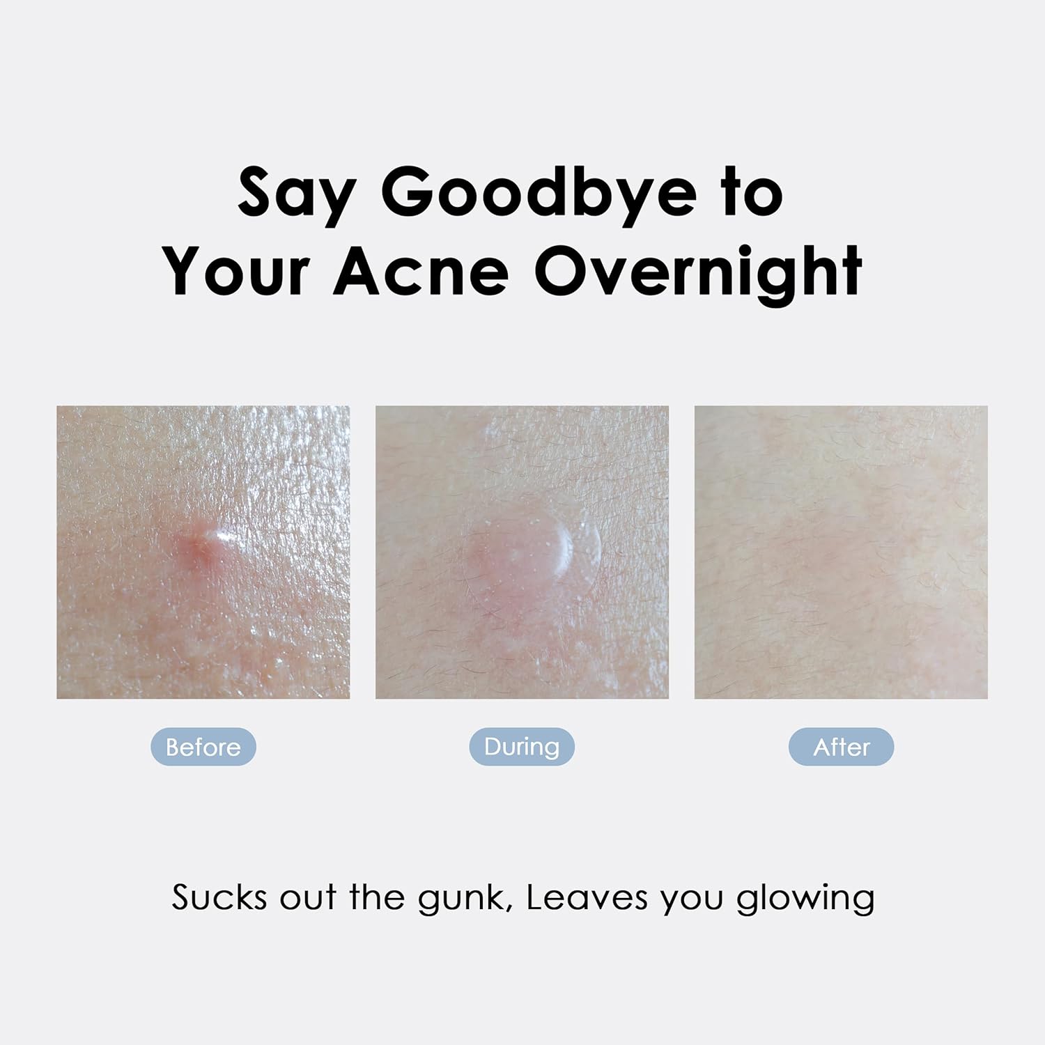 Glowiest Asap Active Spot Alleviating Patch [Bedtime] 52 Patches 8Mm (16Ea), 10Mm (20Ea) & 12Mm (16Ea) | Premium Hydrocolloid Dressing | Simple & Easy Active Treatment : Beauty & Personal Care