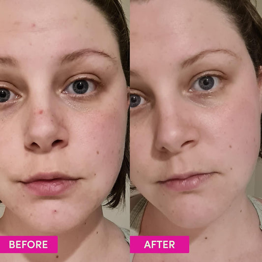 Sand & Sky Australian Glow Berries Brightening Moisturizer With Vitamin C & Squalane - Glow-Boosting Face Cream, Anti-Aging Formula, For Dull Skin