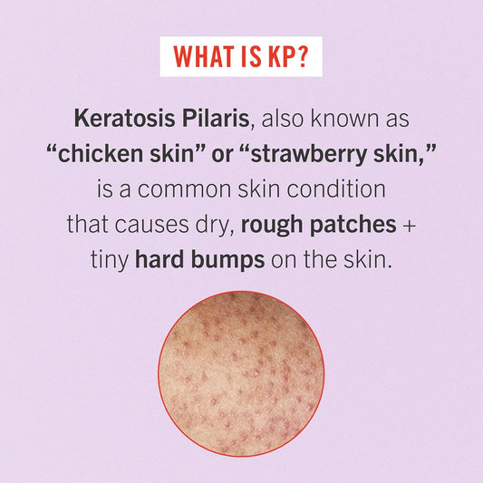 First Aid Beauty - Smooth Operators Trio: Kp Bump Eraser Body Scrub, 8 Oz, Smoothing Lotion, 6Oz, And Ingrown Hair Pads, 28 Pads, Deep Moisture Exfoliating Skin Treatment Set With Bha & Aha, 3Ct