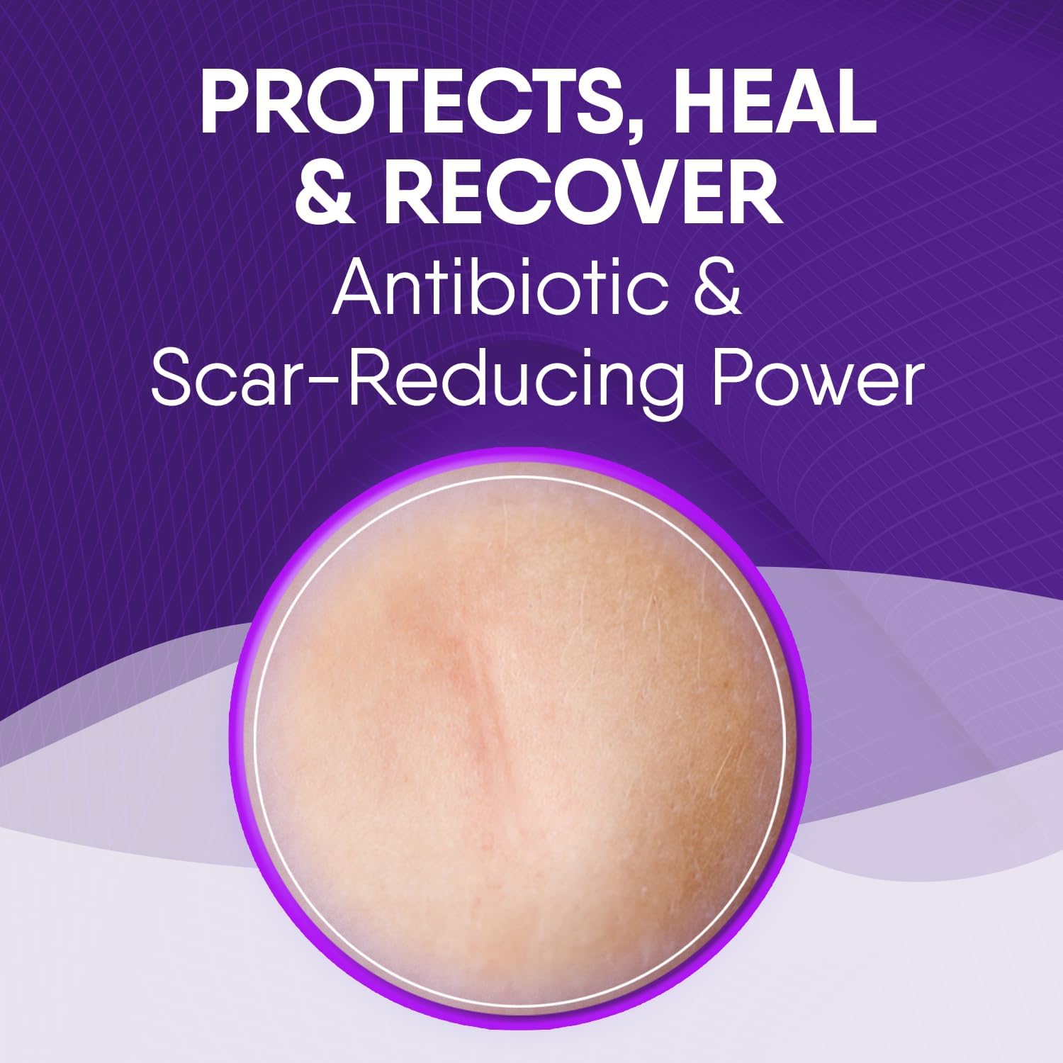 Cicatricure Skin Recovery Kit: Advanced Scar Gel & Open Wound Care Antibiotic Ointment, Reduces Stretch Marks, Surgical & Acne Scars, Treats Cuts & Burns, 1 Oz Each - For Adults & Kids : Health & Household