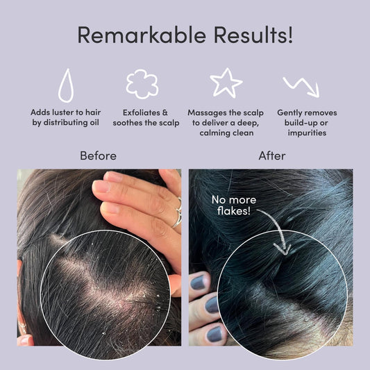 Jupiter Exfoliator Brush For Removing Dandruff & Build-Up - Detangling Scrubber For Wet Or Dry Hair - Supports Circulation & Growth - Vegan- For All Hair Types - Black
