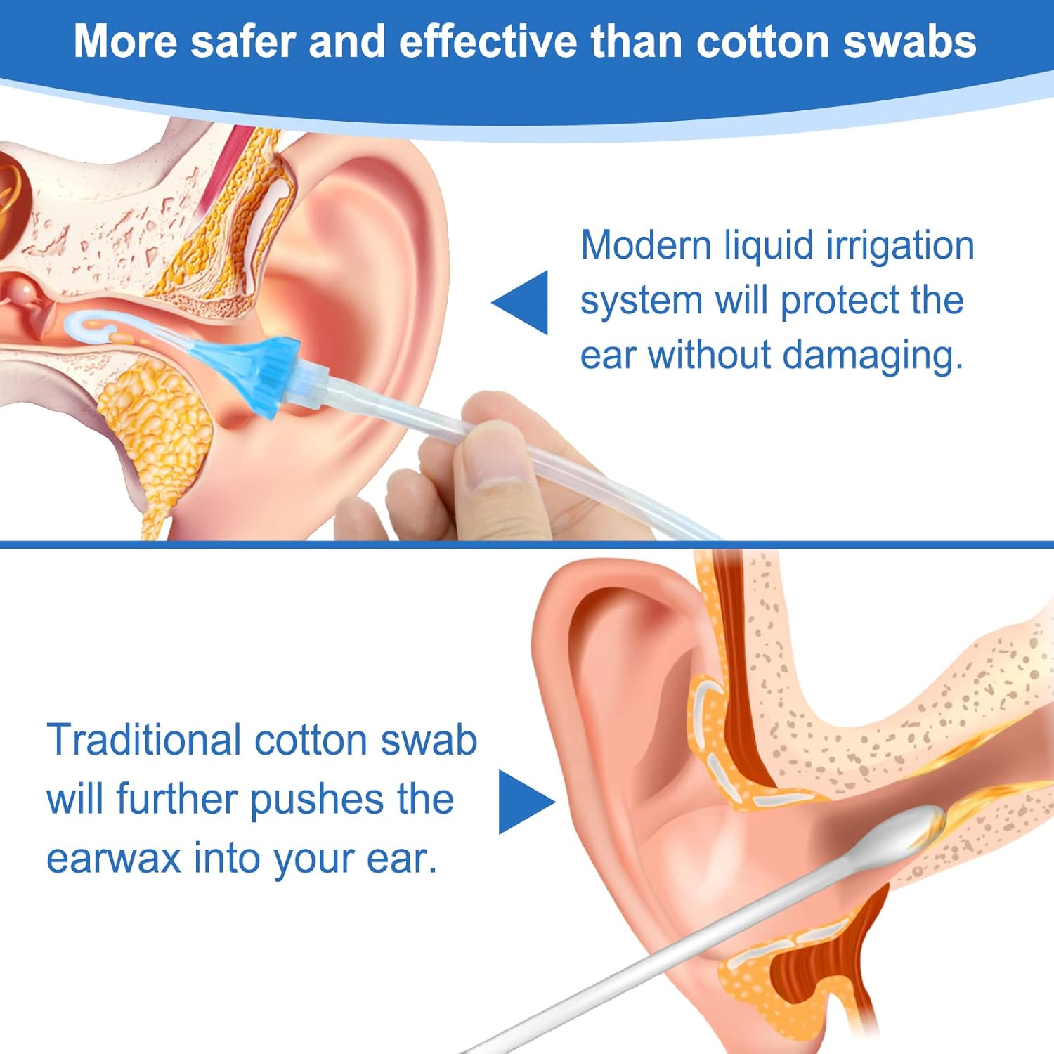 Ear Wax Removal Kit, Bvn Ear Wax Remover, Safe, Effective Ear Cleaner For Adults Children Baby, Safe Ear Shower Ear Rinse, Tool For Earwax Cleaner Removal Set : Health & Household