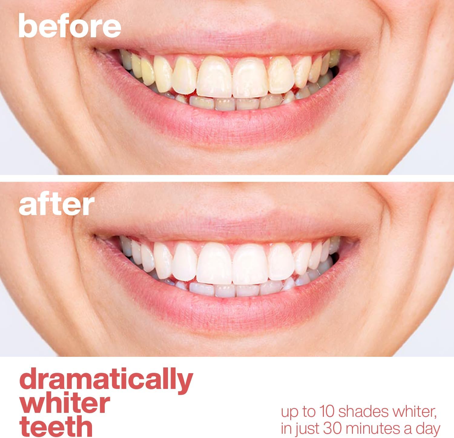 Aquasonic Professional Teeth Whitening Strips - Enamel Safe Teeth Whitening With Hydrogen Peroxide - Easy To Use, Non-Slip, Affordable & Effective (Watermelon) : Health & Household
