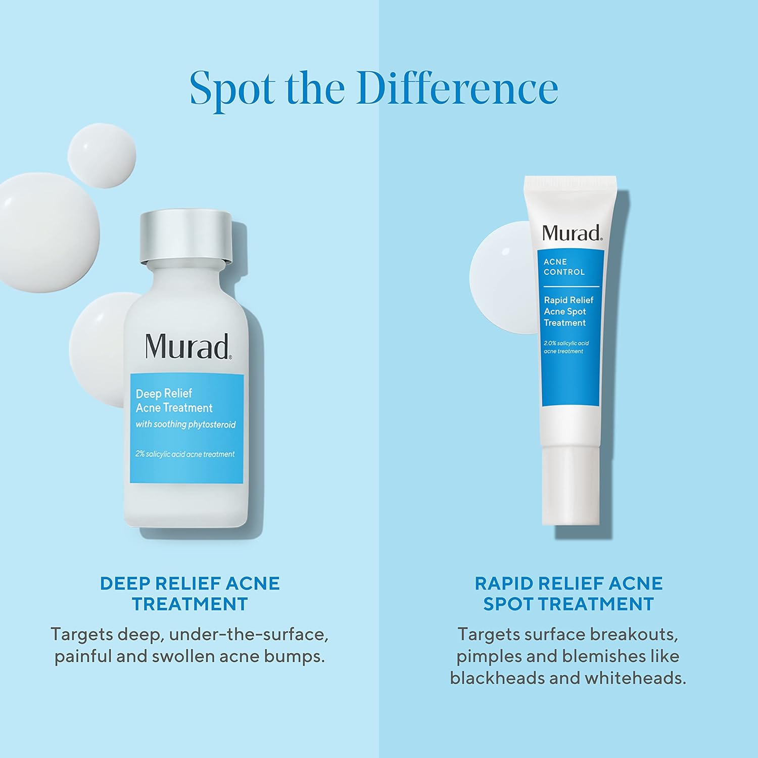 Murad Deep Relief Acne Treatment - Maximum Strength Acne Treatment With 2% Salicylic Acid And Phytosteroid For Deep, Painful Acne Breakouts And Redness - Accelerated Healing Treatment - 1 Fl Oz : Beauty & Personal Care