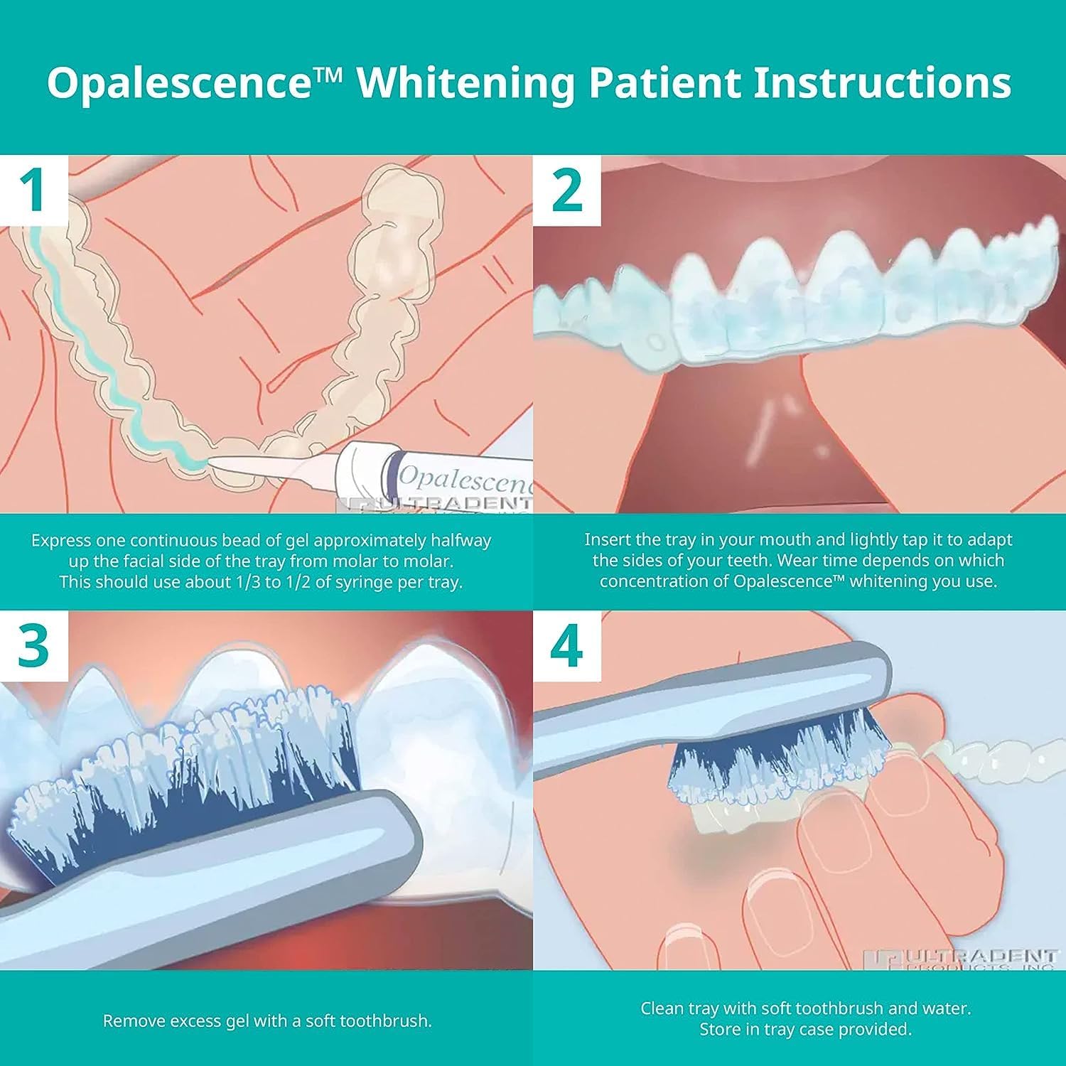 Opalescence 20% Gel Syringes Teeth Whitening - Refill Kit (8 Syringes) Carbamide Peroxide, Fluoride. Made by Ultradent, in Mint Flavor. Tooth Whitening - 5196-4 : Health & Household