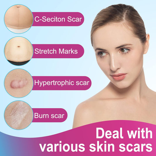 Silicone Scar Sheets,Silicone Scar Tape Roll,Medical Grade Silicone Tape For Scar Removal,Reusable Professional Scar Treatment Patch For C-Section,Keloids,Surgical,Acne (Roll Size 1.6''X75''-1.9M)