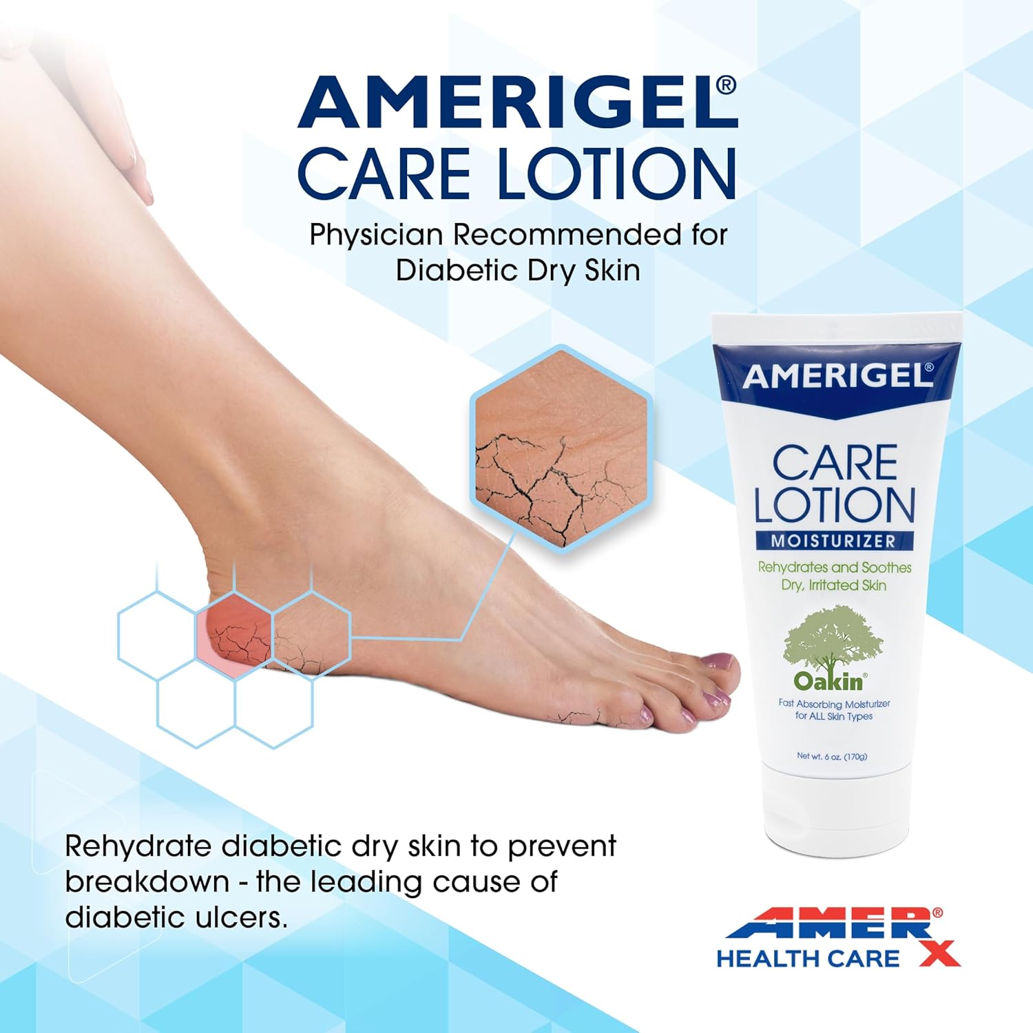 Amerigel Care Lotion – Hypoallergenic Moisturizer - Diabetic Skin Care - Rehydrates And Soothes Dry, Irritated Skin - 6 Oz. : Beauty & Personal Care