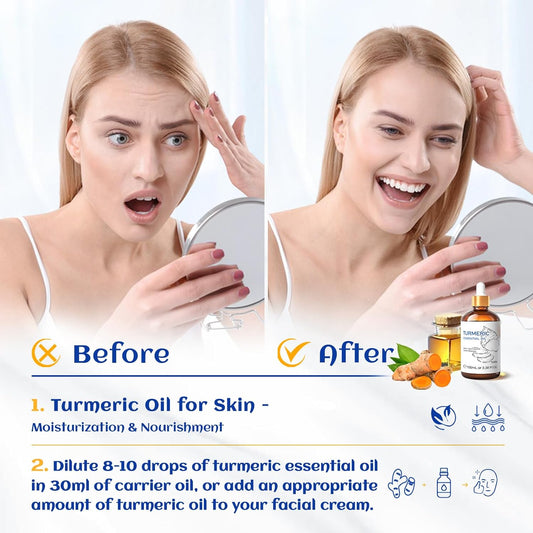 HIQILI Turmeric Oil for Face Dark Spots, Face Problems,100% Pure, Use After Dilution- 3.38 Fl Oz