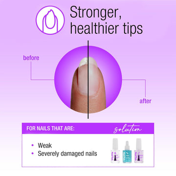 Nail Tek Xtra 4, Nail Strengthener For Weak And Damaged Nails, 0.5 Oz, 1-Pack