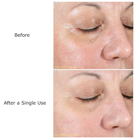 Aha Refresh Facial: Glow Ritual System With Daily Moisturizer, Multi Peel, Neutralizing Milk Cleanser For Skin Renewal (Activator Sold Separately)