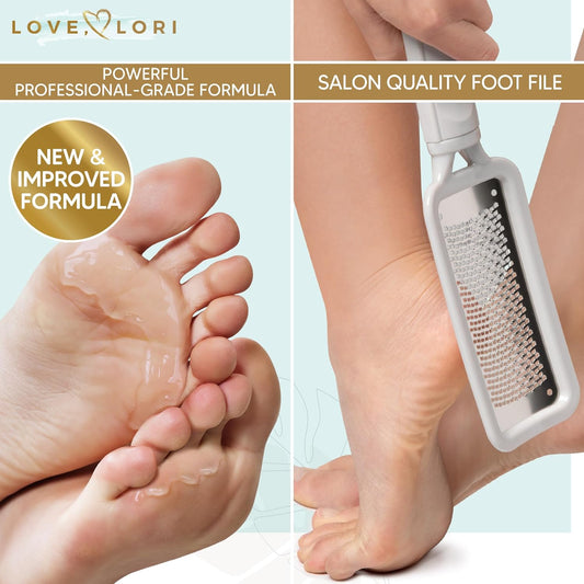 Love, Lori Foot Scrubber File & Callus Remover Gel Bundle - Feet Scrubber Dead Skin - Foot Spa Kit