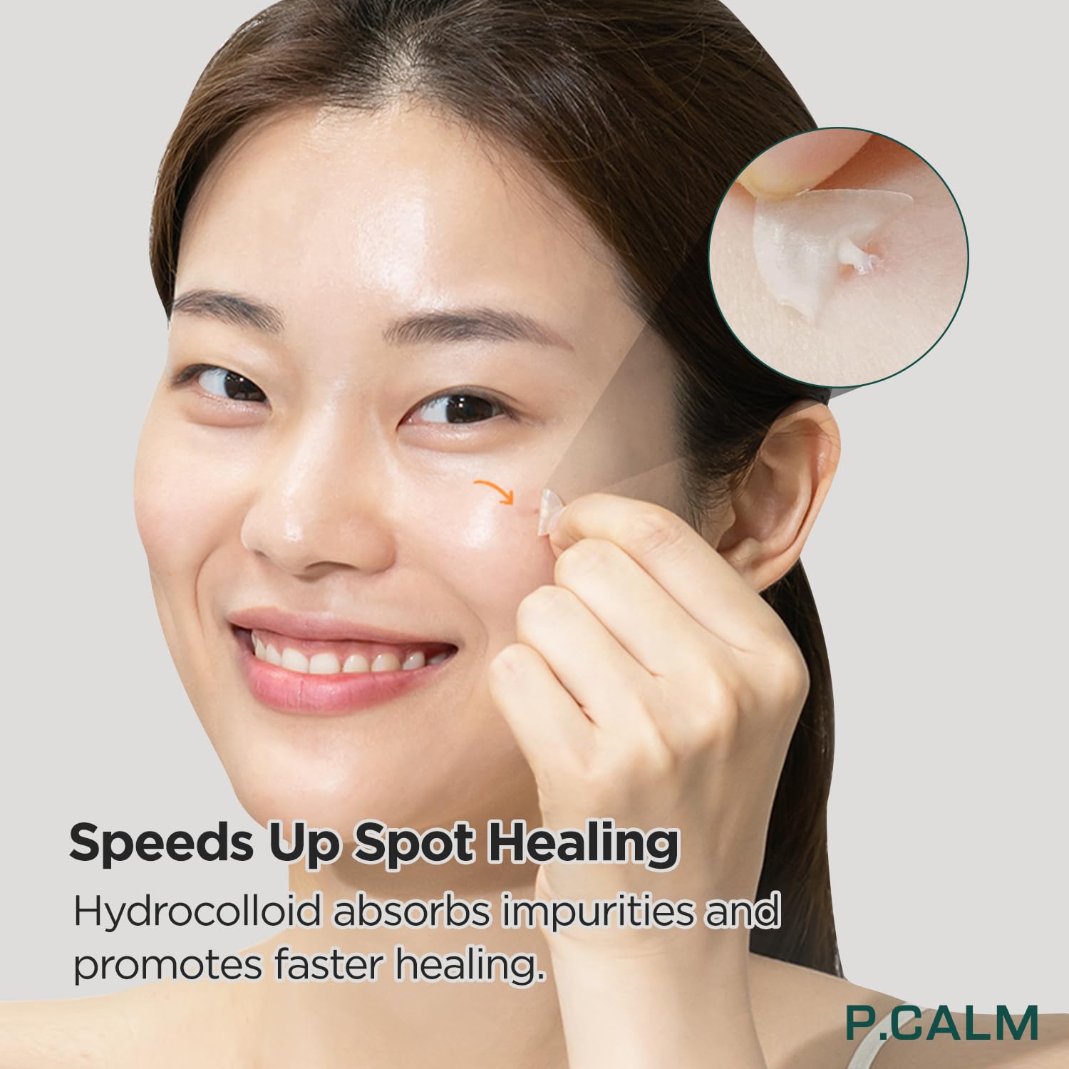 P.Calm Allday Clear Spot Patch 36 Counts | Korean Skin Care For Sensitive Skin | Hydrocolloid With Niacinamide, Salicylic Acid, Tea Tree, Centella