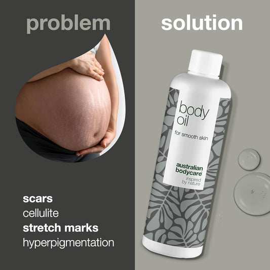 Australian Bodycare Body Oil - Improve The Appearance Of Stretch Marks, Scars, Orange Peel Skin (Cellulite), Pigment Spots And Uneven Skin Tone Try Body Oil With Tea Tree Oil For Whole Body – 150 Ml