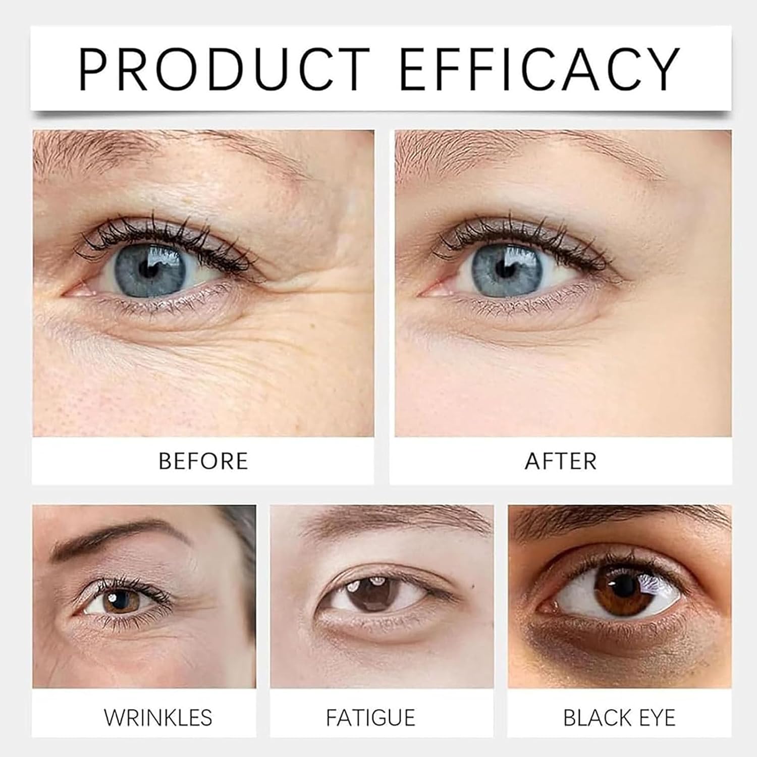 Vc Anti-Wrinkle Eye Serum Oil, Ruy Eye Oil Vc, Vceye Serum O Il, Lutein Eye Essence Oi L, Improve E Yes Bags Dark Circles For Women Men (2Pcs)