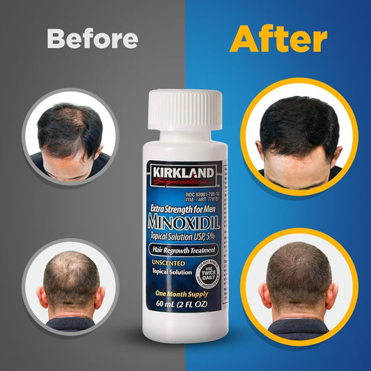 5% Minoxidil Topical Solution for Men - 6 Month Supply (6 x 2 Fl Oz), Hair Regrowth Treatment with Dropper, Cleaning Cloths & Travel Pouch