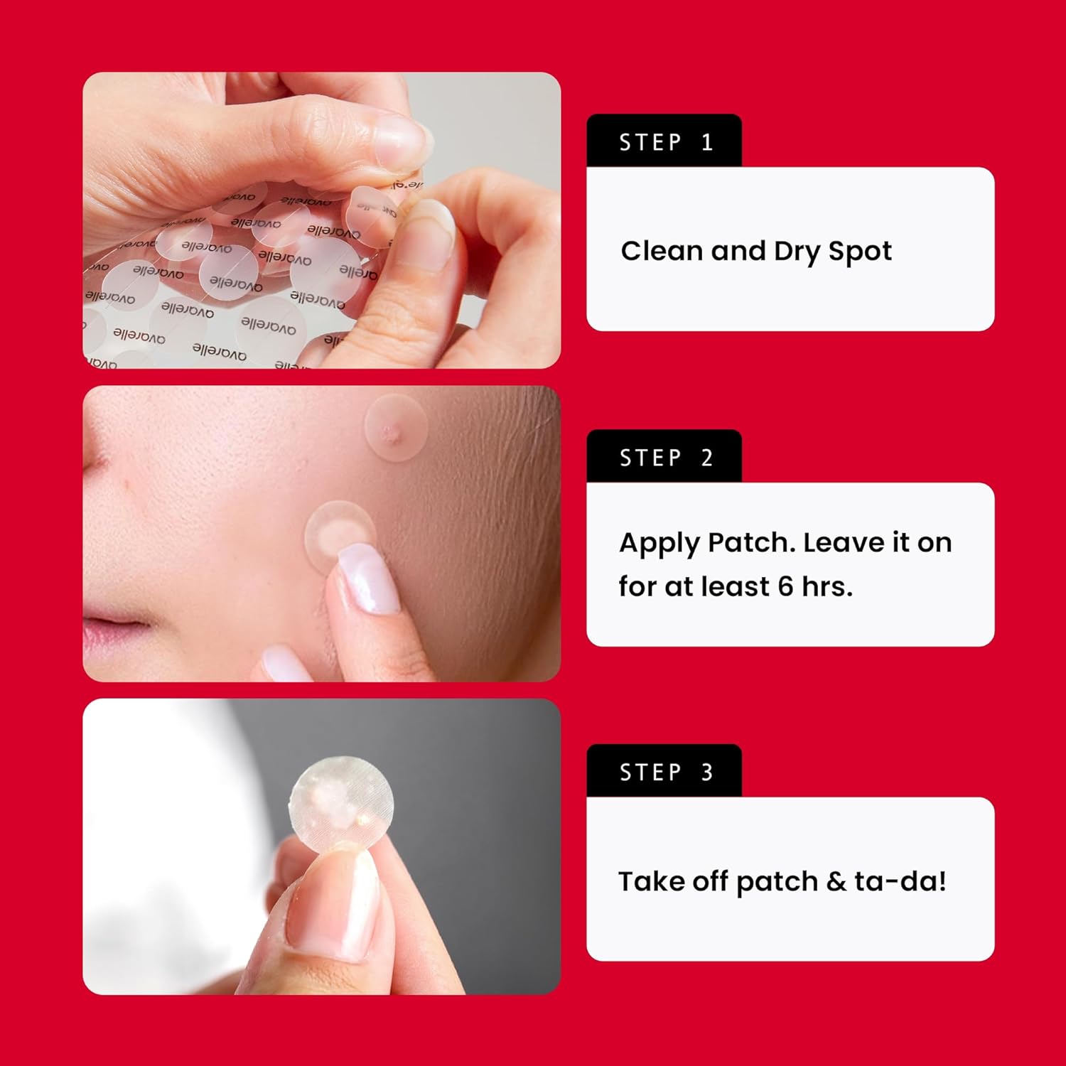 Avarelle Acne Pimple Patch (40 Count) Absorbing Hydrocolloid Spot Treatment With Tea Tree Oil, Calendula Oil And Cica, Certified Vegan, Cruelty Free (Variety / 40 Count) : Beauty & Personal Care