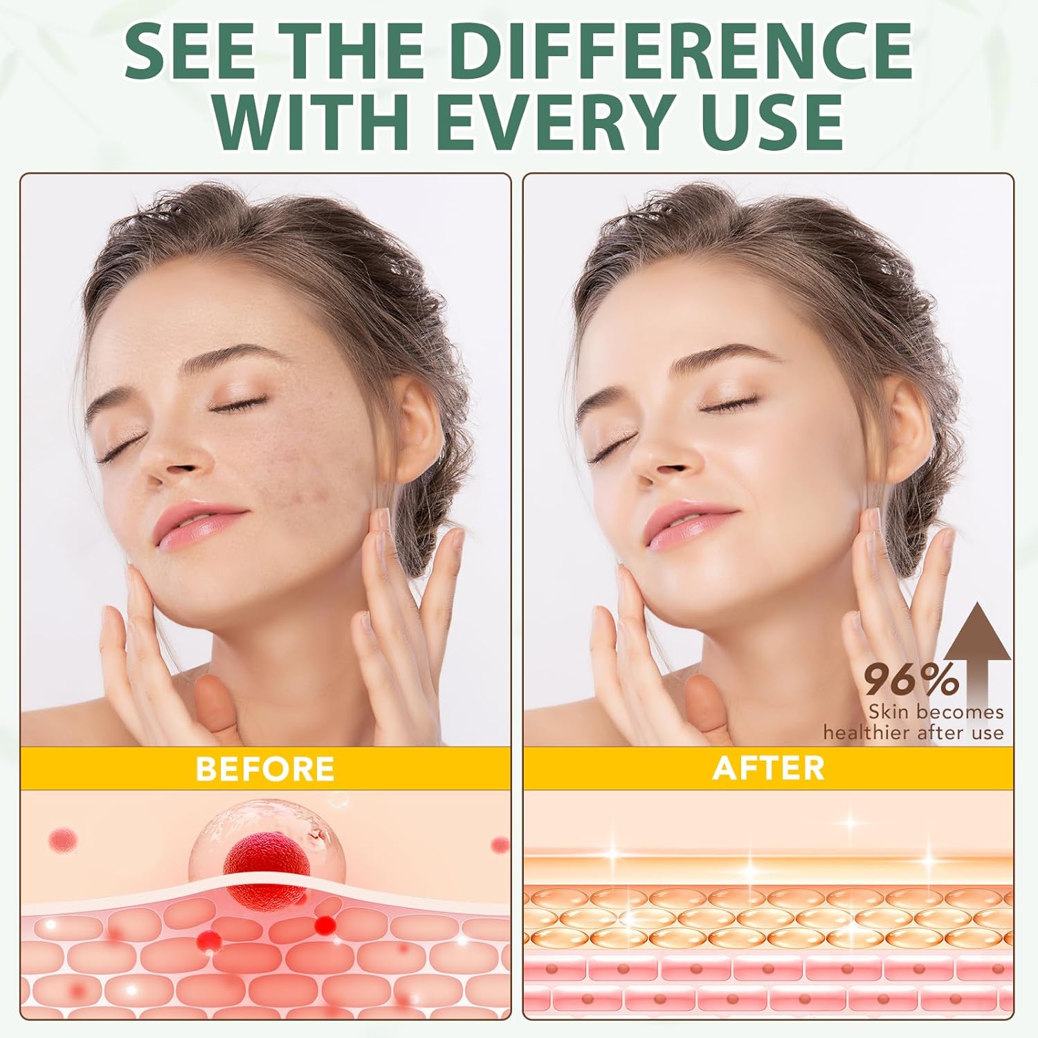 Laraspi Beef Tallow For Skin, Beef Tallow Moisturizer, 4.2 Oz Organic Whipped Grass Fed Beef Tallow With Honey Cream For Face & Body, Unscented : Beauty & Personal Care