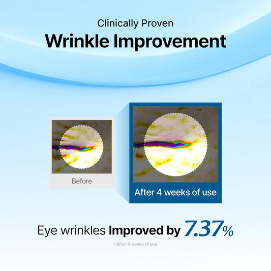 [Klairs] Midnight Blue Youth Activating Drop · Egf + Peptide Ampoule For Sensitive Skin · Calms Redness, Boosts Firmness & Sebum Control · Lightweight & Fast-Absorbing · 0.67 Fl Oz