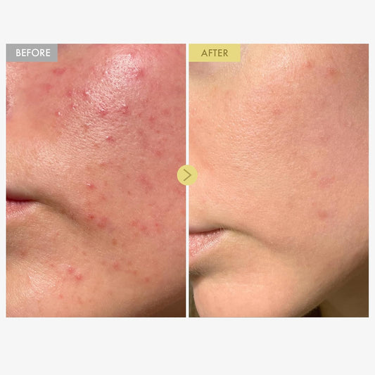 Black Snail Mucin 92% Face Cream, 920,768Ppm Black Snail Mucin, Propolis, Lightweight Moisturing Cream For Soft, Glowy Skin, Moisturizer Face Cream, Korean Skin Care, 100Ml, 3.38 Fl.Oz